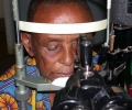 arumeru-cataract-patient-before-surgery